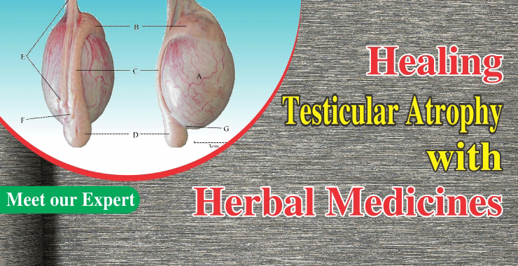 Testicular Atrophy