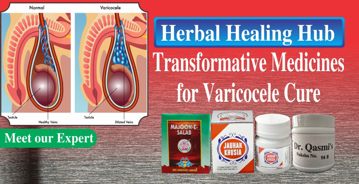 Varicocele